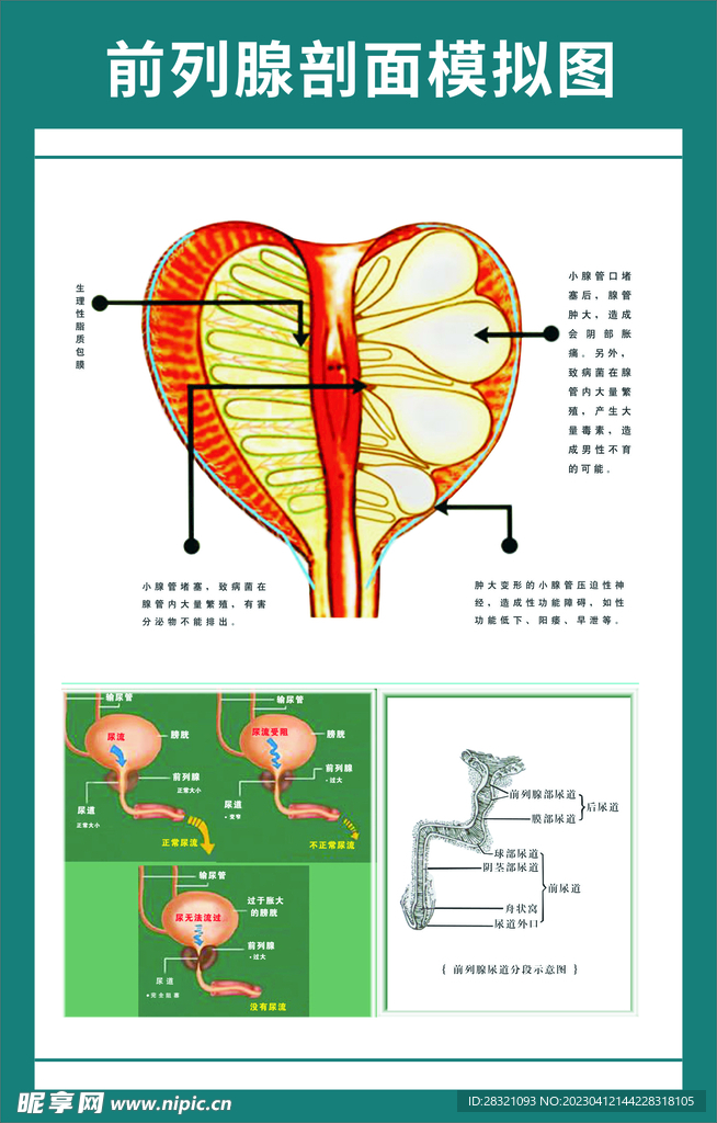 前列腺剖面图