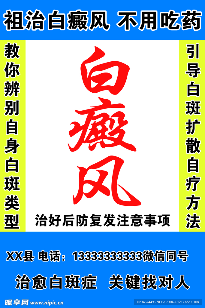 白癜风