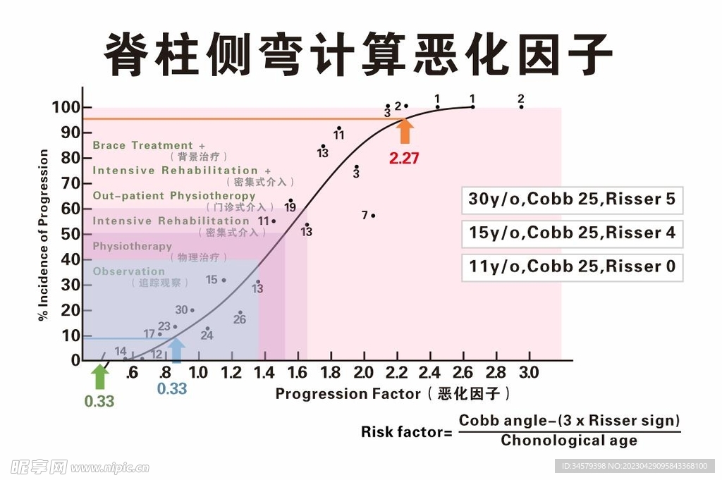 脊柱侧弯计算恶化因子