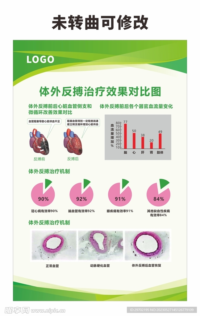 医院医疗心肺康复科制度牌展牌