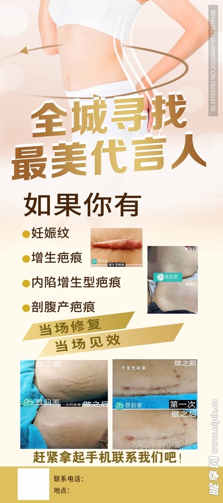 减肥美容展架