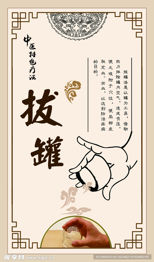 拔罐