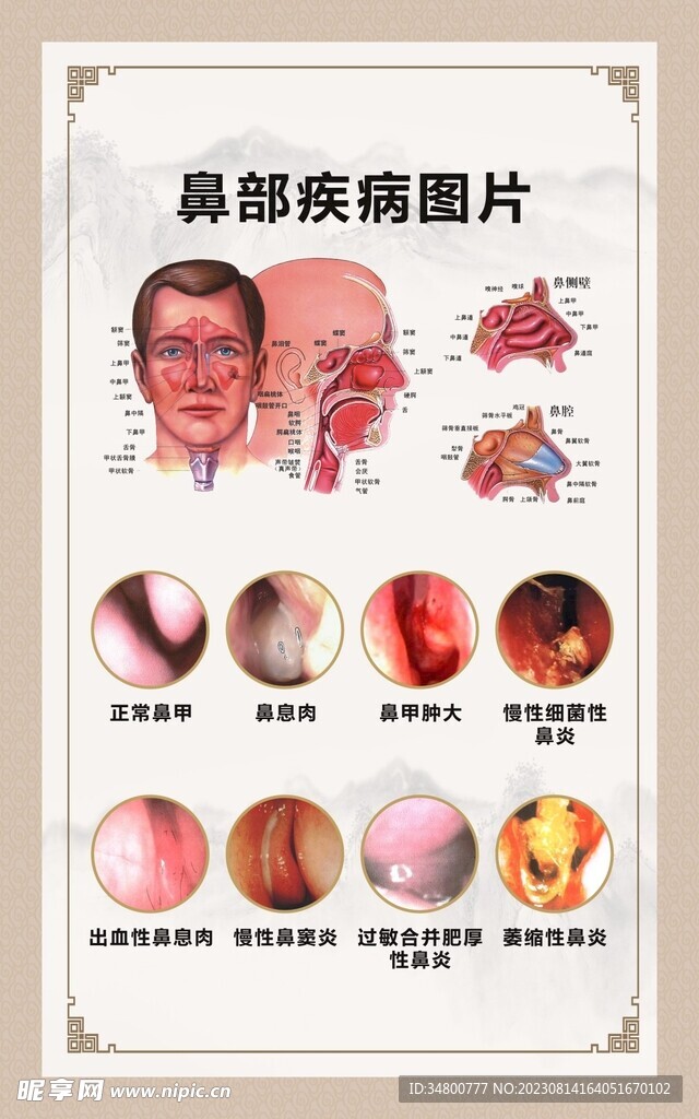 鼻部疾病图片