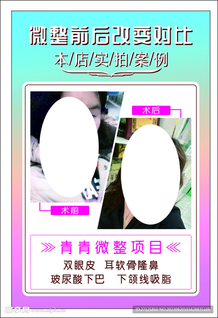 美容 微整