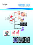 医院海报 心脑血管疾病 蓝色