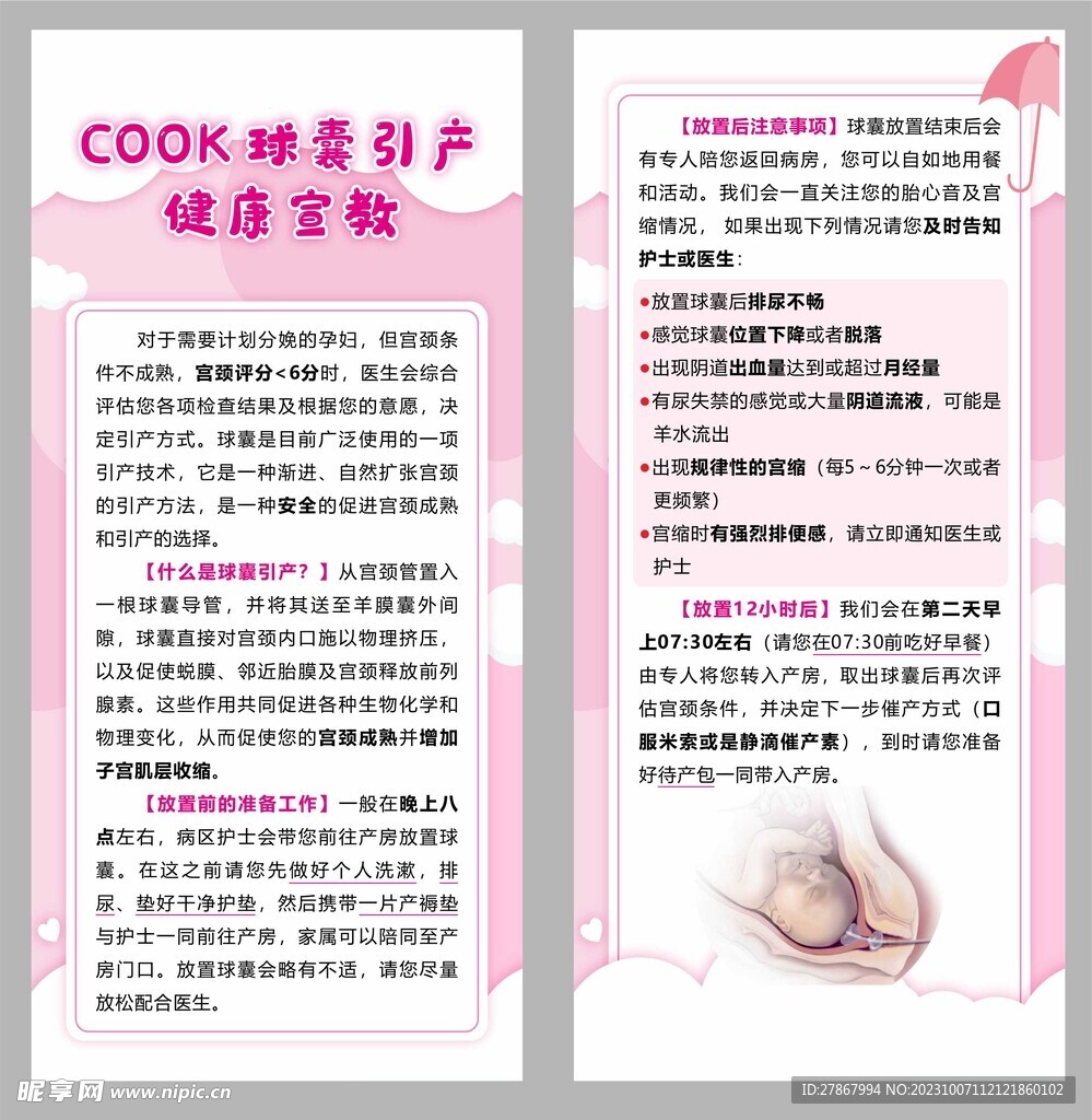 COOK球囊引产健康宣教