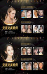 医美暗金变美案例对比展示