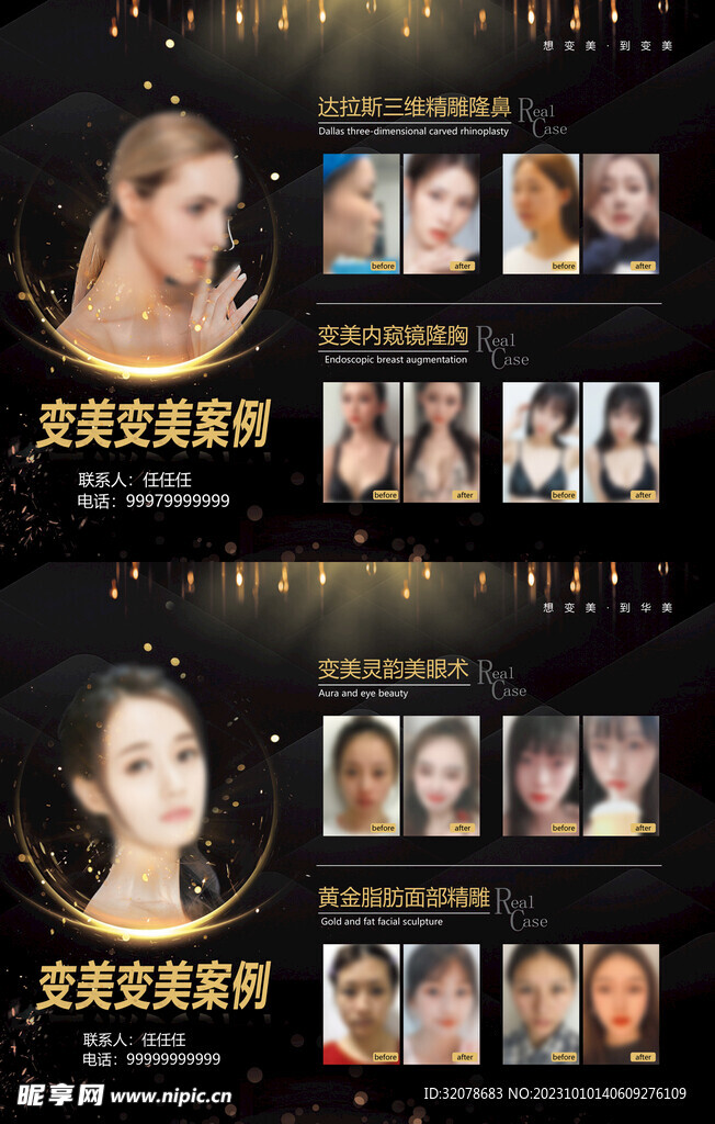 医美暗金变美案例对比展示