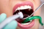 口腔  医疗 补牙 牙科 手术