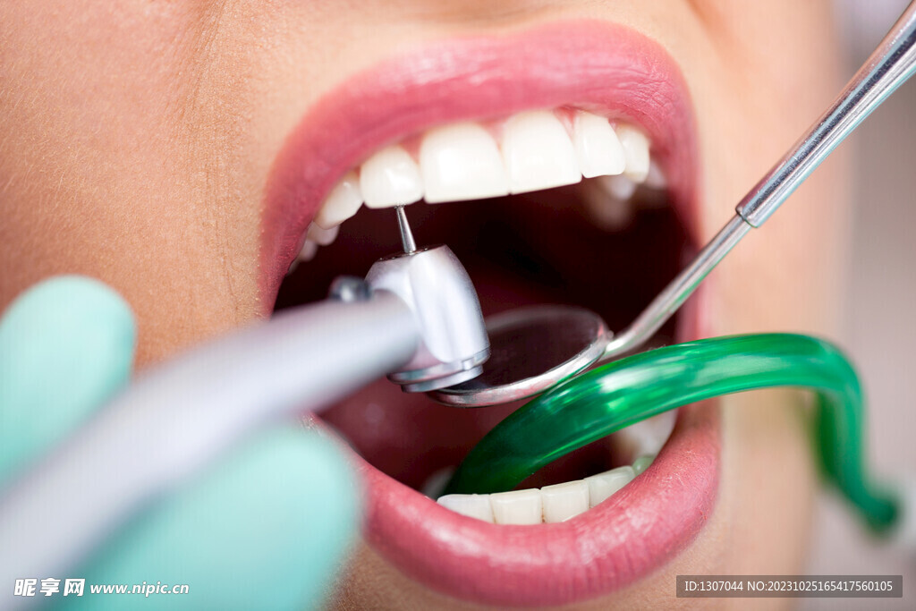 口腔  医疗 补牙 牙科 手术