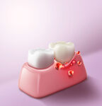 牙齿 模型  口腔 3D  