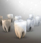 牙齿 模型  口腔 3D  
