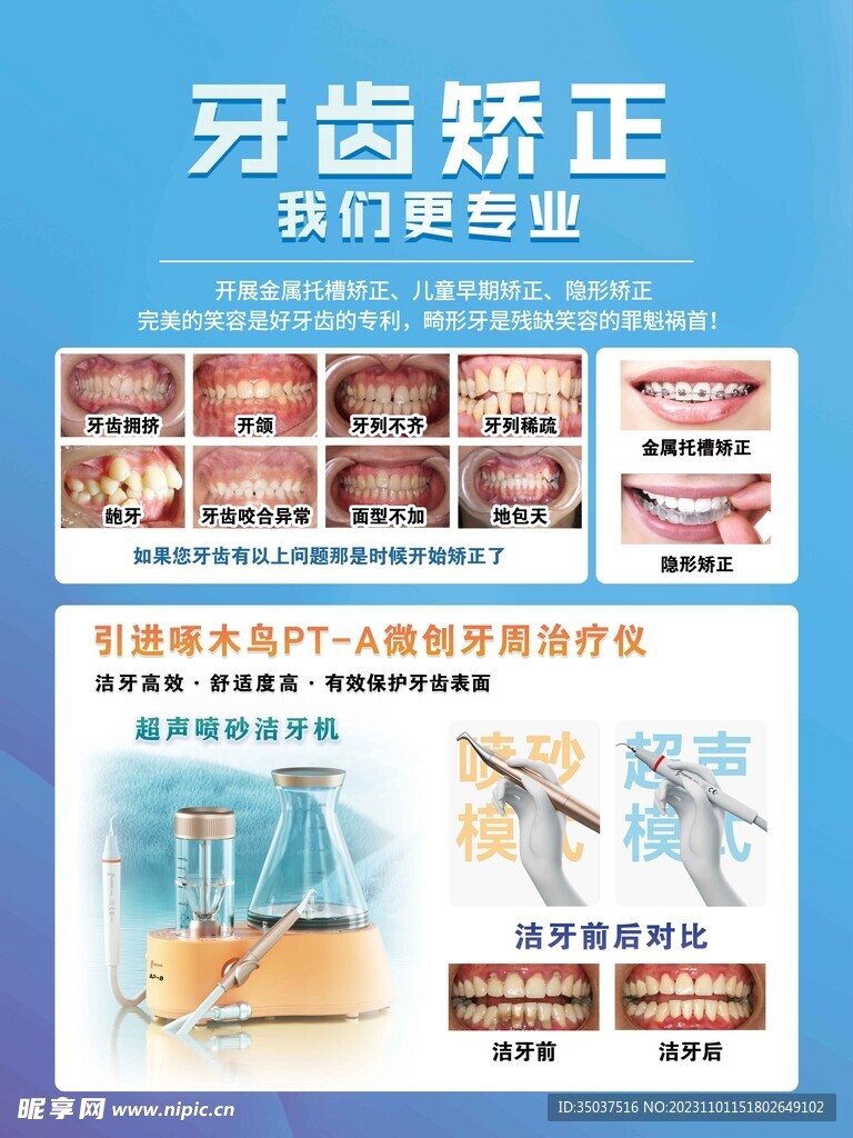 牙齿矫正 牙医