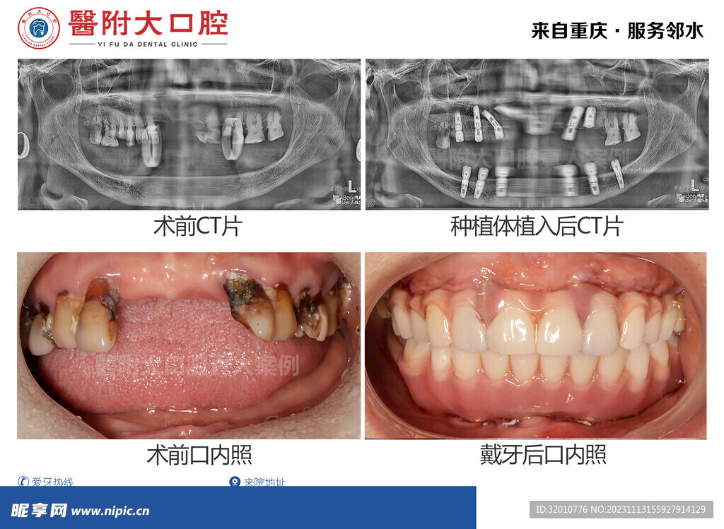 牙齿案例