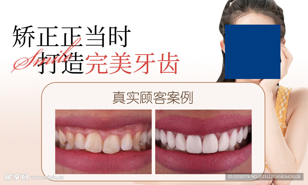 牙齿矫正