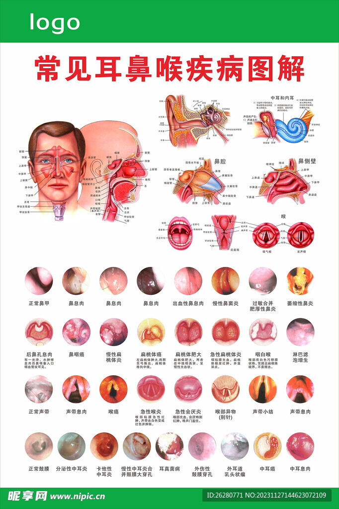 耳鼻喉疾病图谱
