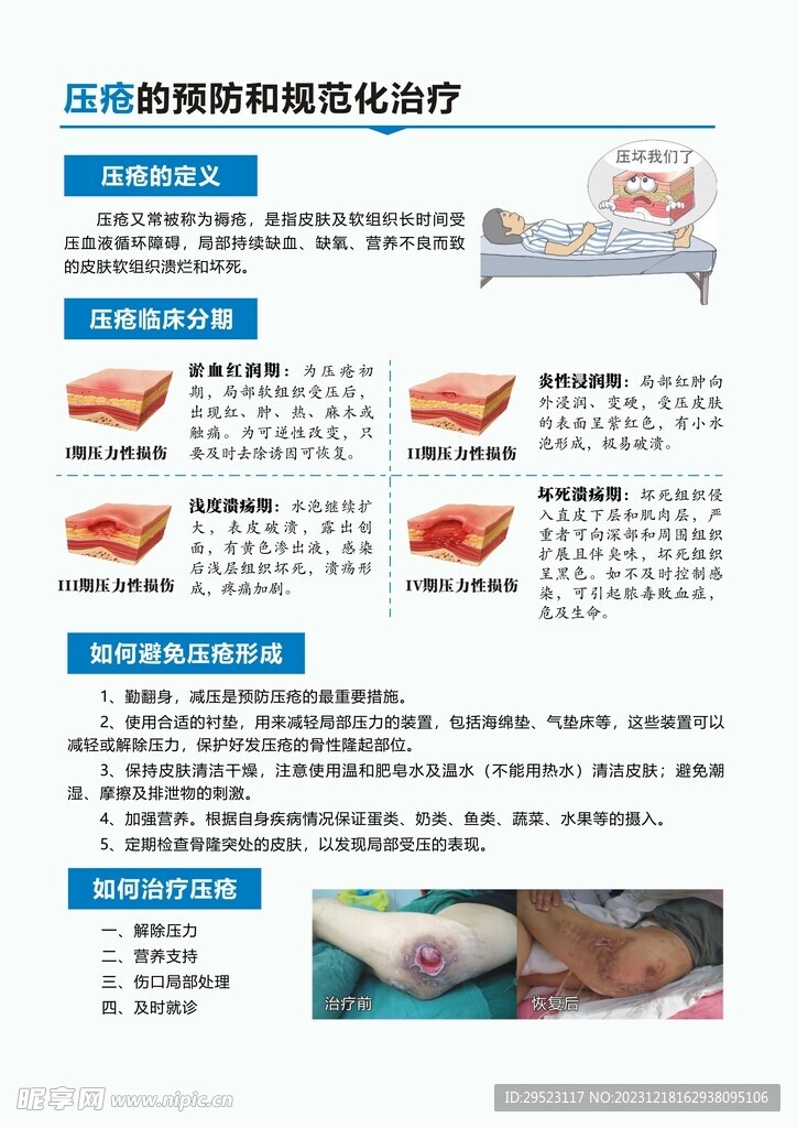 压疮的预防和规范化治疗