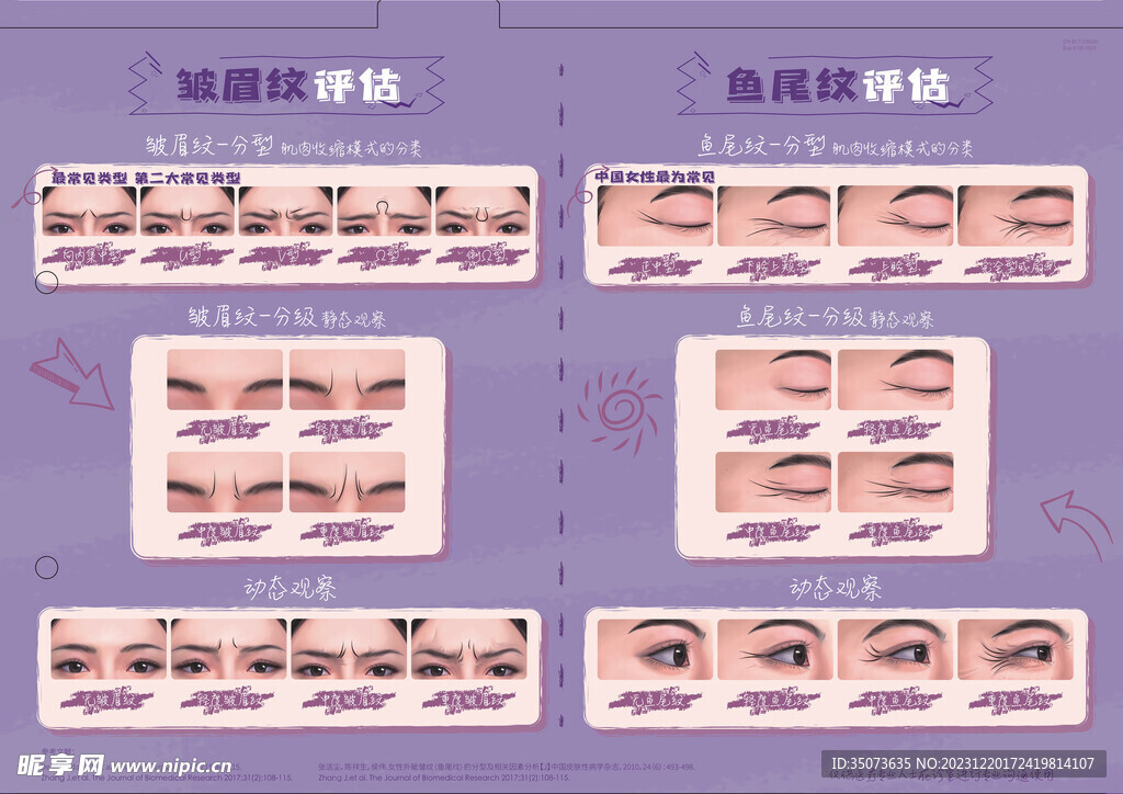 医美整形 眉间纹 鱼尾纹