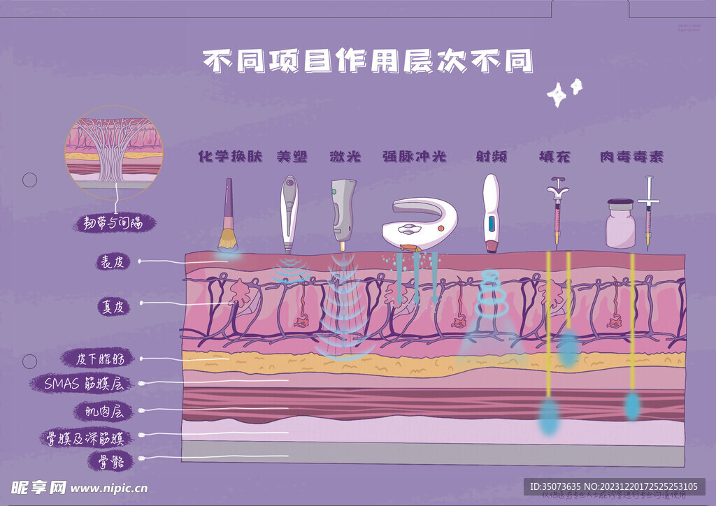 医美整形 皮肤激光层次 