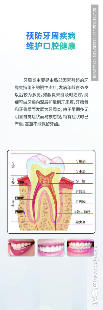 牙周病挂画