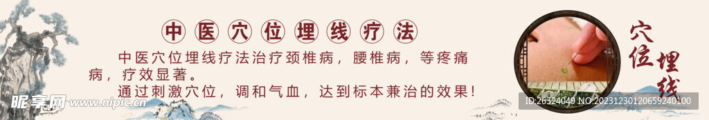 穴位埋线
