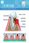 牙本质敏感与牙周问题