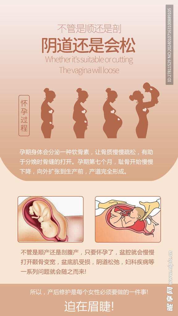 不管是顺还是剖阴道还是会松