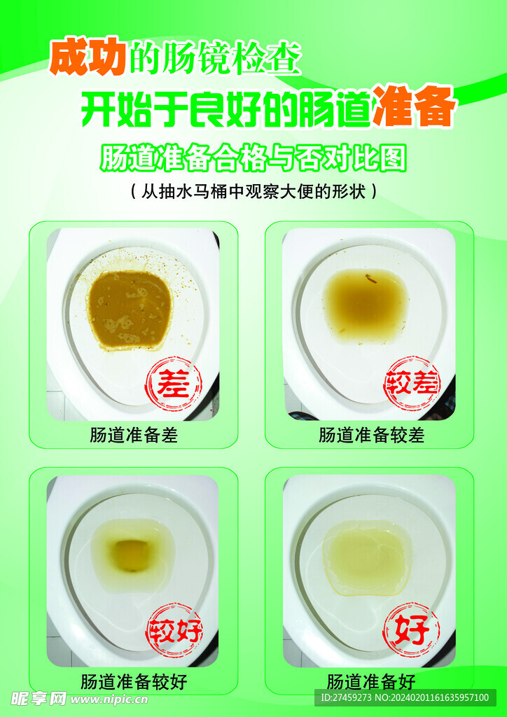 肠道检查