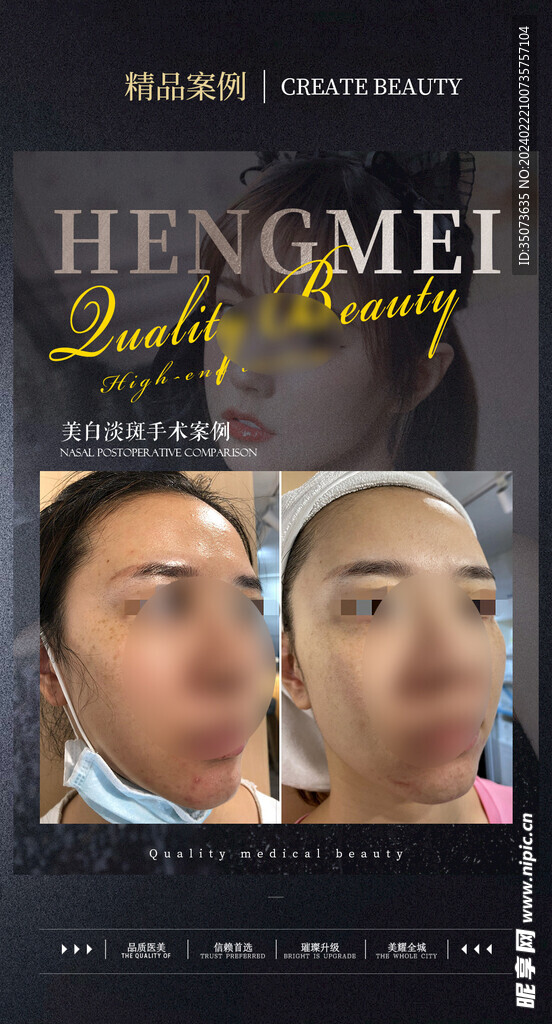 医美案例对比