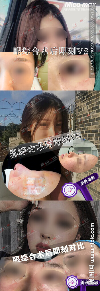 医美案例对比