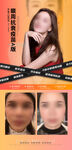 医美案例展示