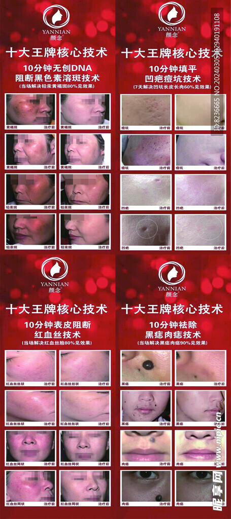 祛斑展架画面海报
