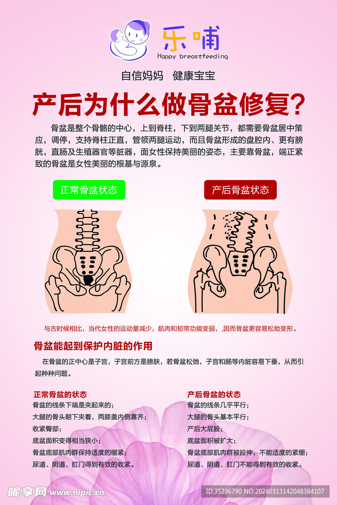 骨盆修复