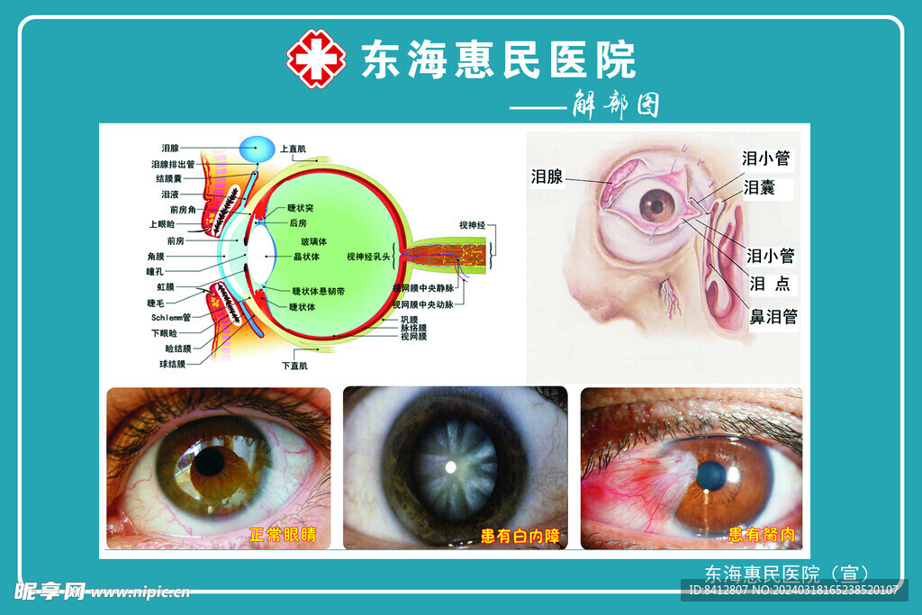 惠明医院  白内障 眼科 眼球