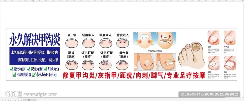 甲沟炎海报 灯箱