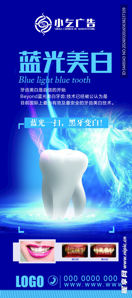 牙齿美白