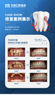 牙科修复案例展示