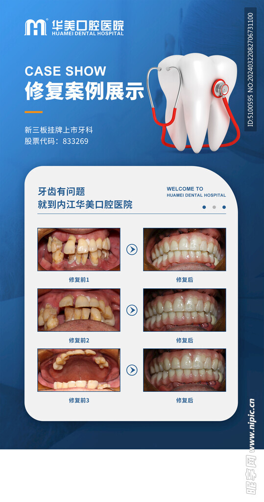 牙科修复案例展示