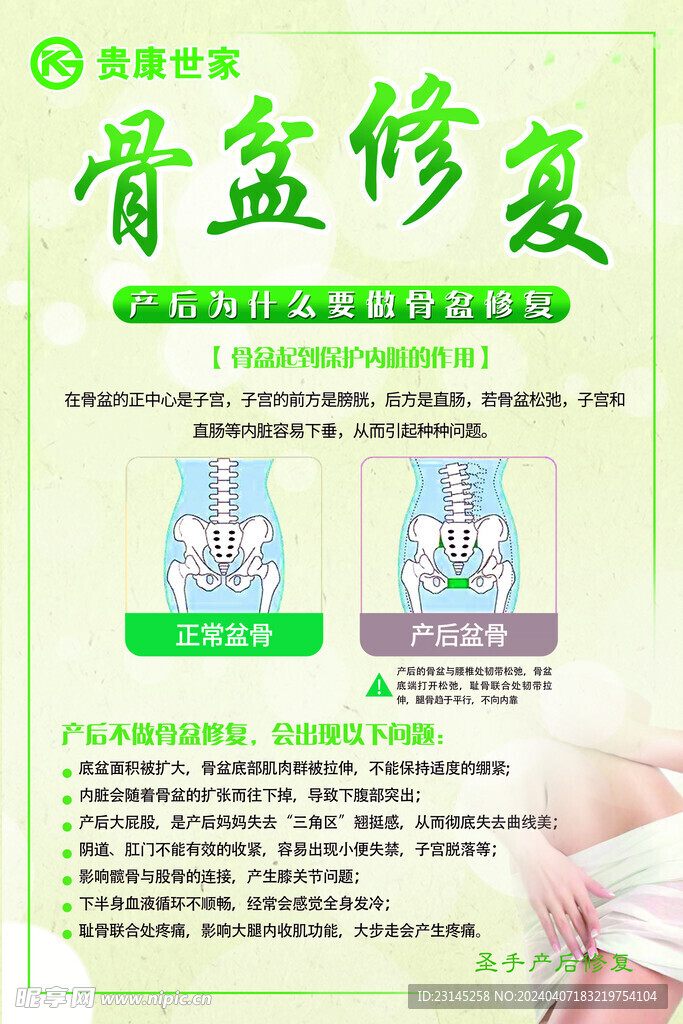 骨盆修复