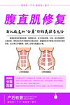 腹直肌修复 海报
