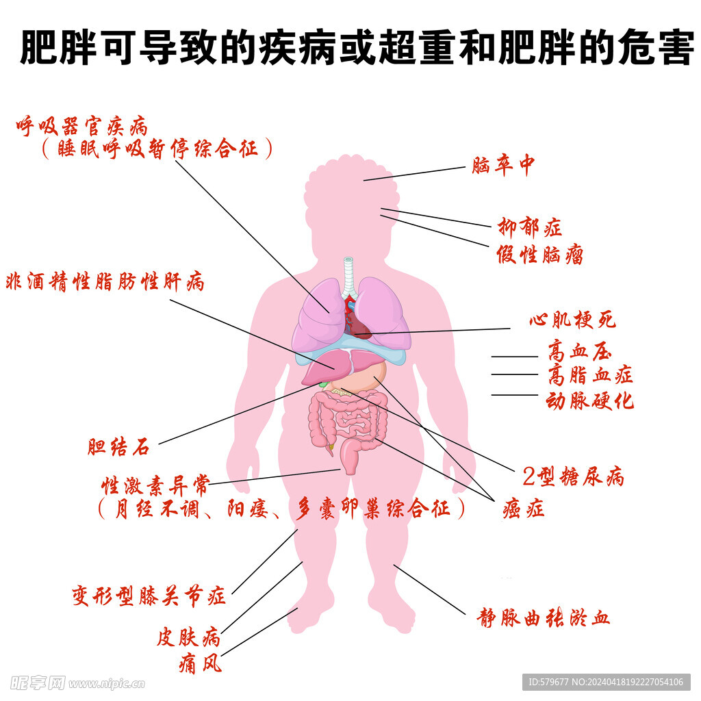 肥胖测量尺