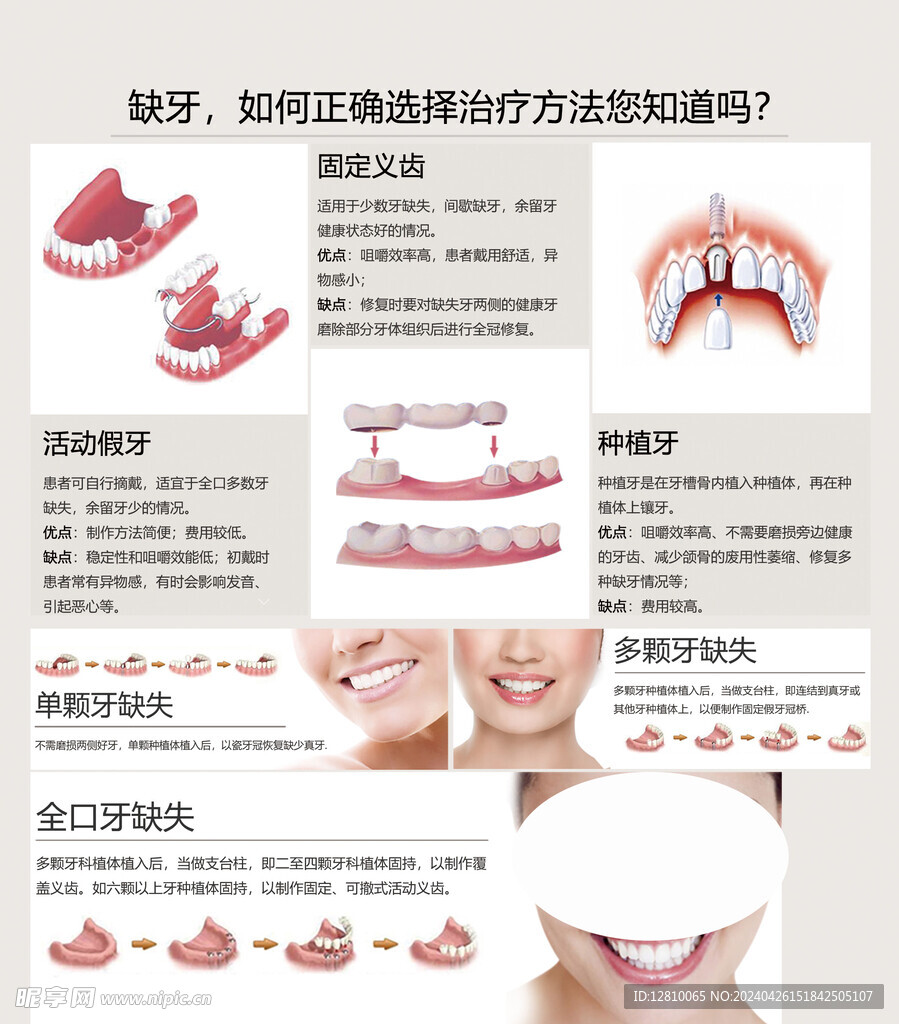 缺牙口腔知识海报