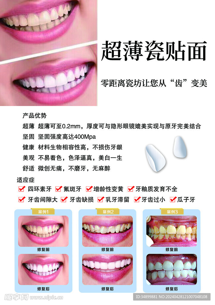 牙齿