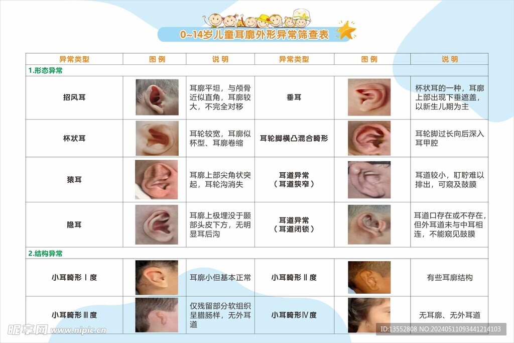 耳廓外形异常筛查