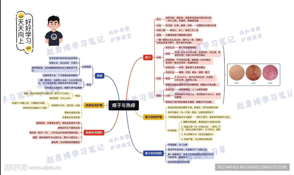 痱子与热疹细节介绍