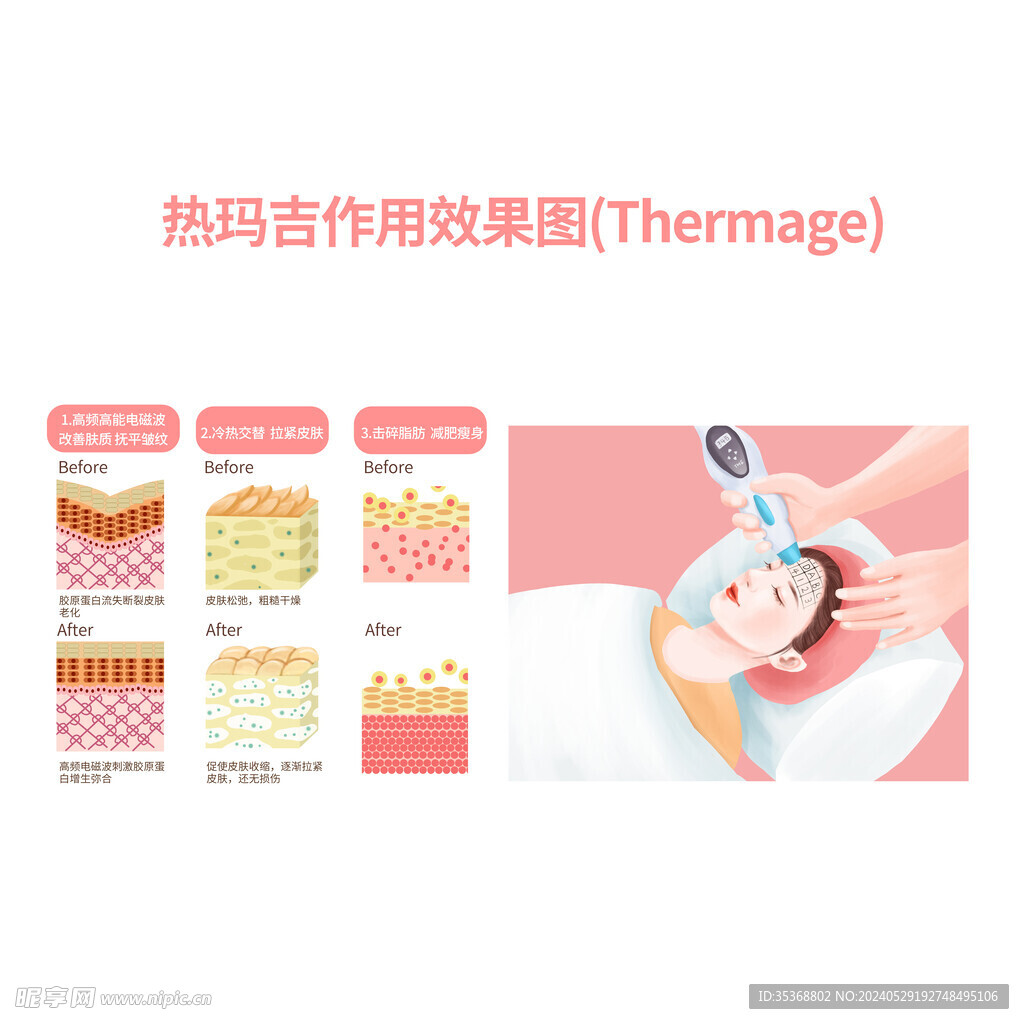 热玛吉