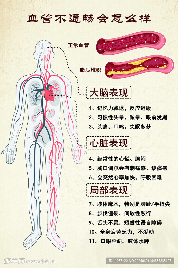 血管不通畅