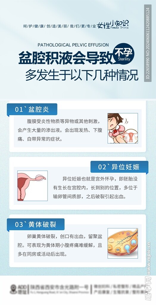 盆腔积液妇科