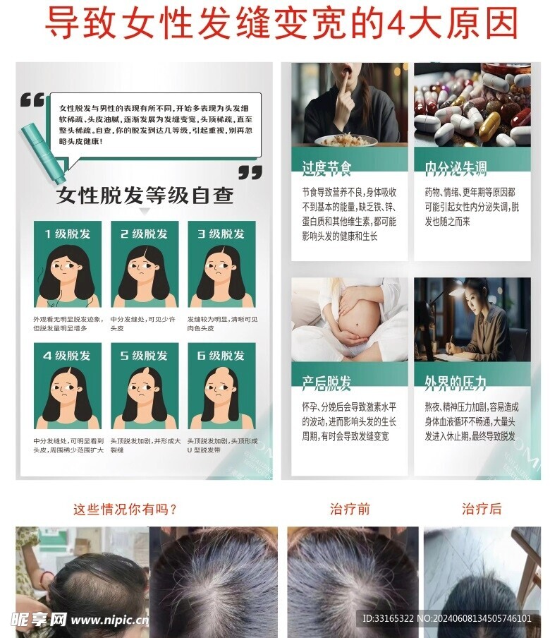 诊所展架