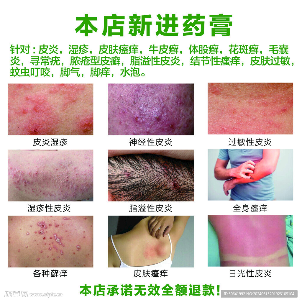 皮肤病
